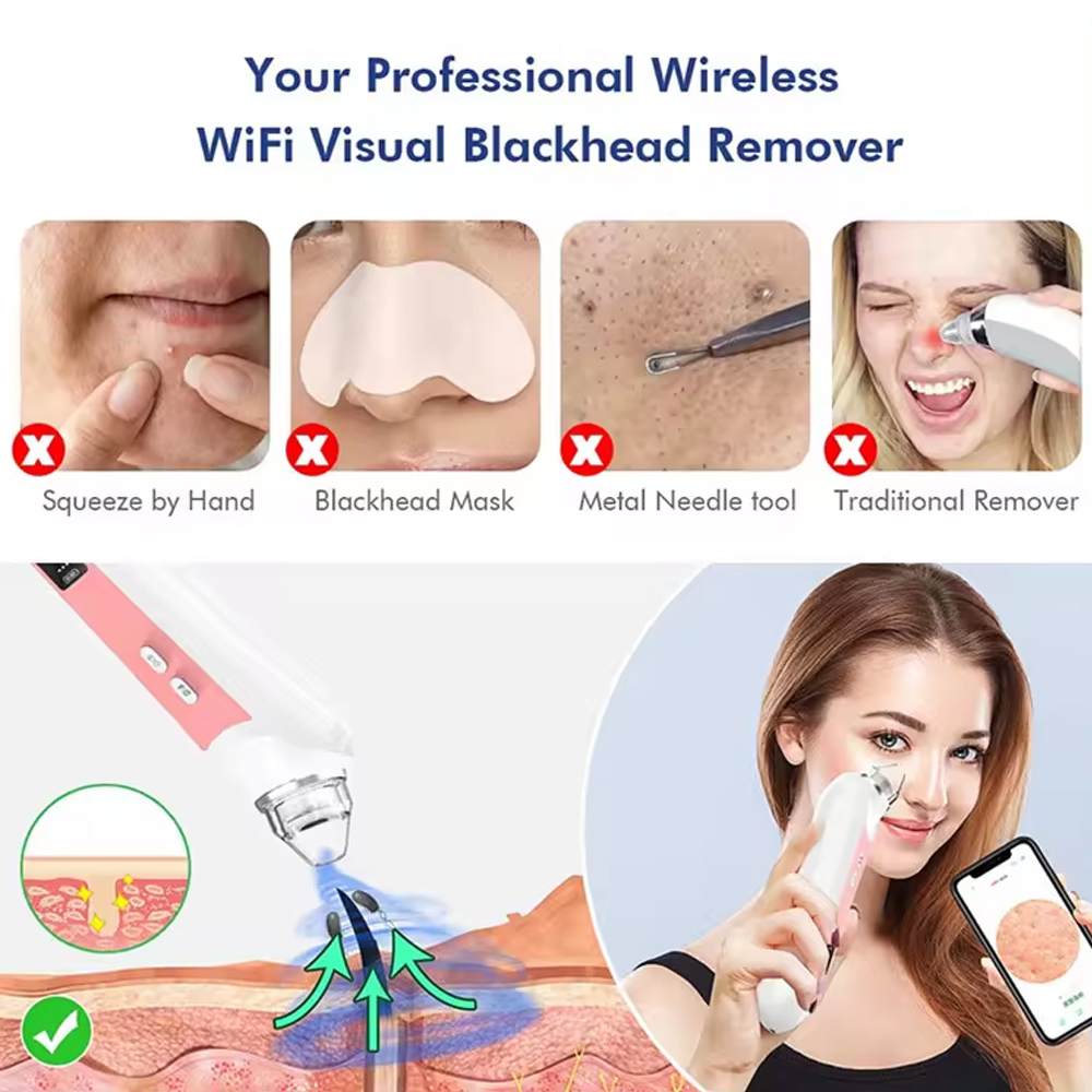 6 Köpfe Poren reiniger Mitesse – Nasal Aspirator Bewertung und Preis